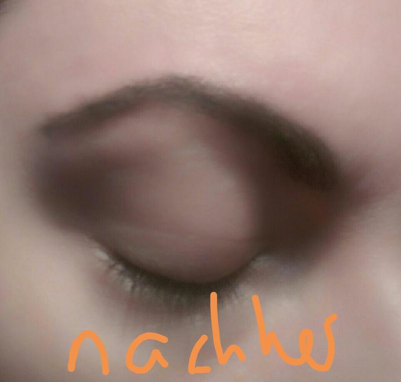 Nachher