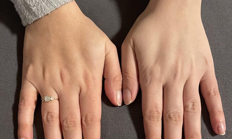 Rechts mit Puder, links ohne