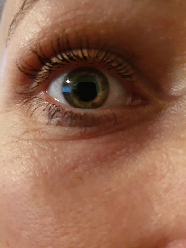 Avis sur la photo 1.