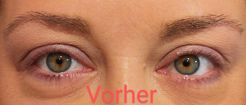 Bewertung von Foto 1