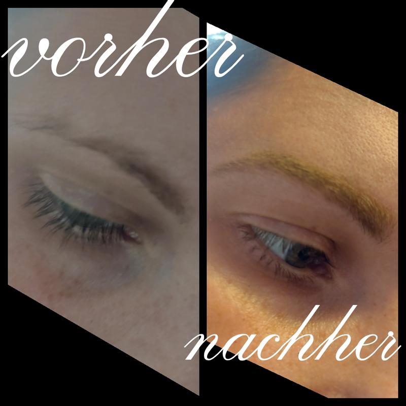 Vorher/Nachher