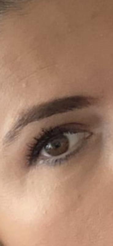 Augen