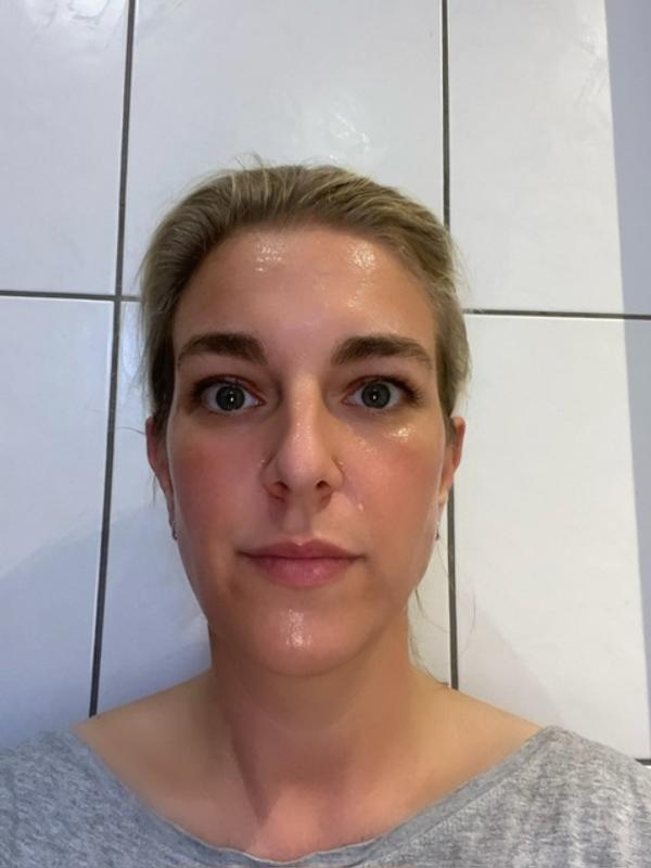 L‘ORÉAL Vitamin C Sofort Glow Serum Maske -abgemacht und man sieht wie das Serum gewirkt hat