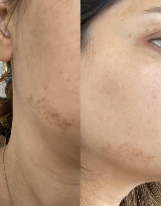 Changes in my skin