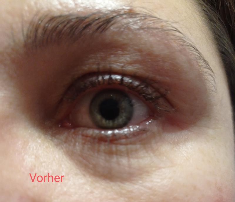 Vorher