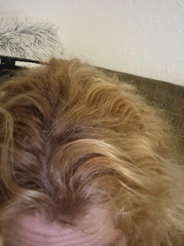 Nachher
