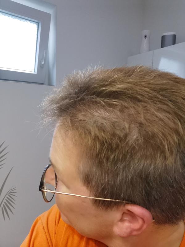 Vorher. Durch viel Sonne im Urlaub sehr ausgeblichen