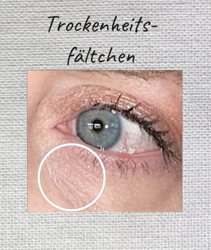 Trockenheit unter dem Augen