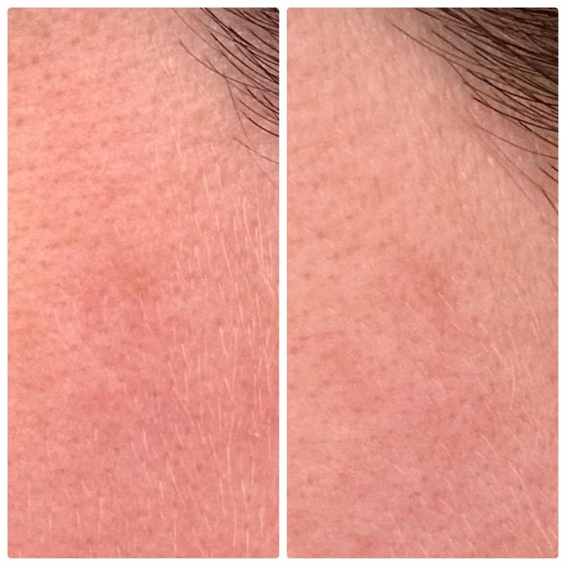 Links vorher, rechts nachher: schon nach kurzer Zeit ein Verblassen des Sonnenflecks!