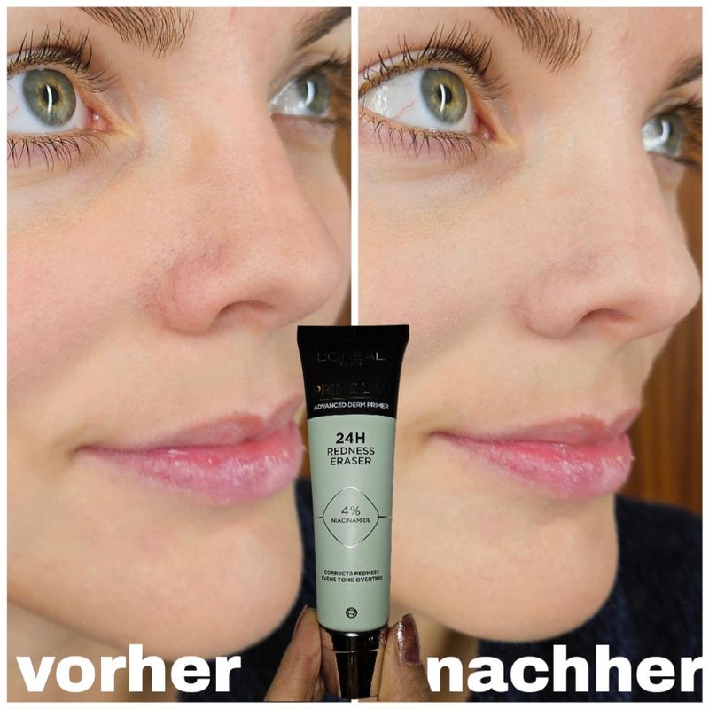 L'Oréal Paris 24h Redness Eraser Primer vorher - nachher