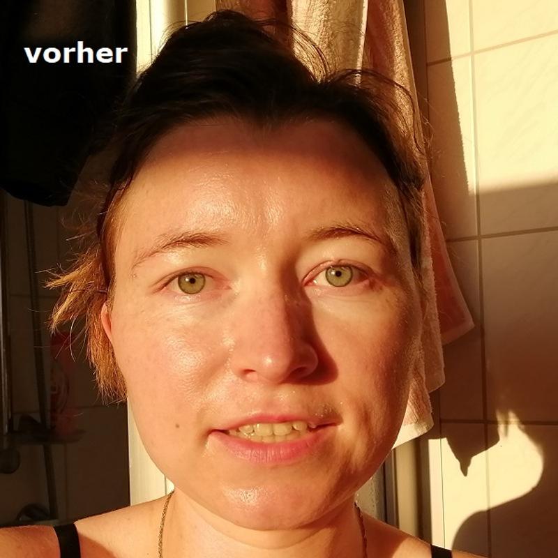 [Werbung] L’ORÉAL Paris Revitalift Clinical Pures 12 % Vitamin C Serum Haut vorher
