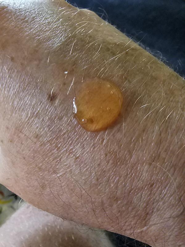 Das Gel