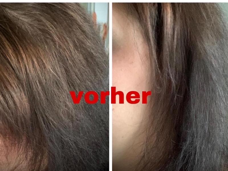 Vorher