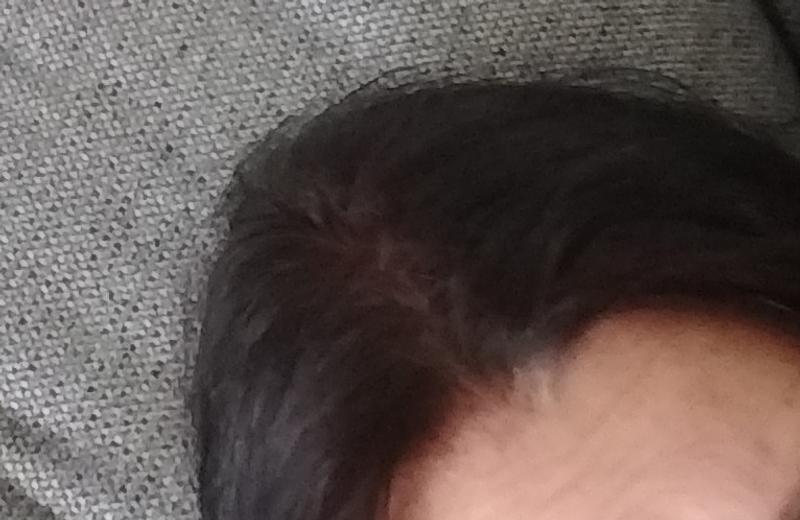 nachher