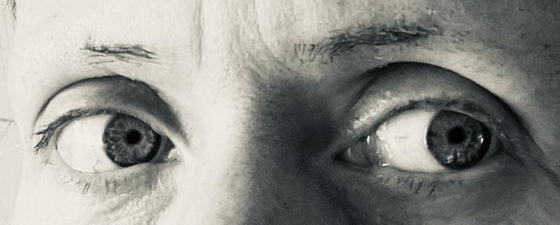 Brauen mit Narben und gezupft - ohne Unbelievia Brow…