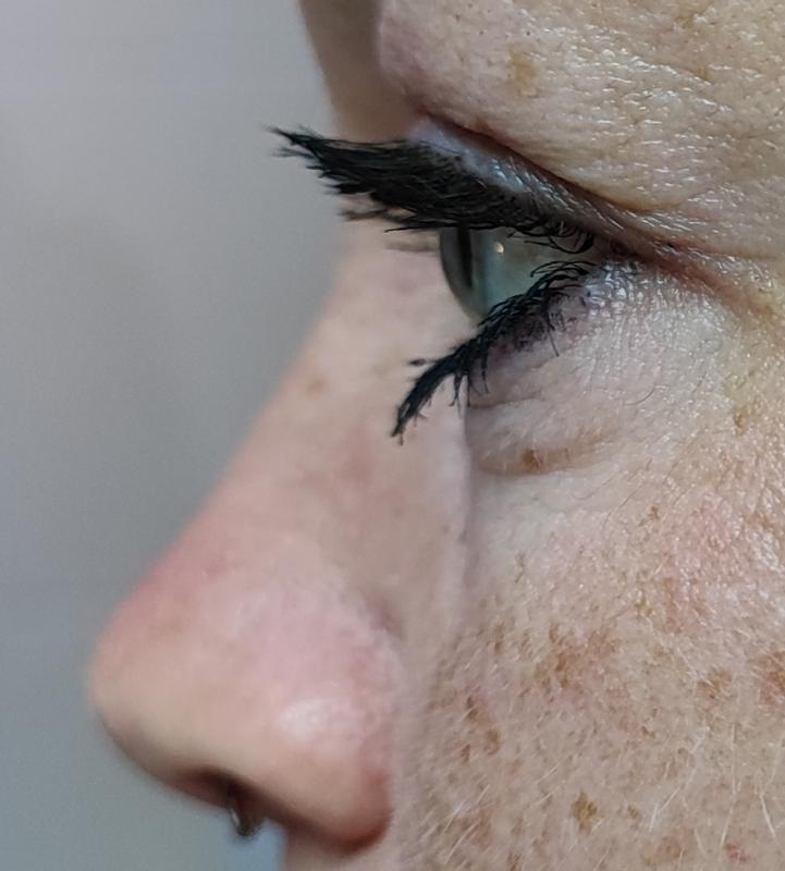 Linkes Auge