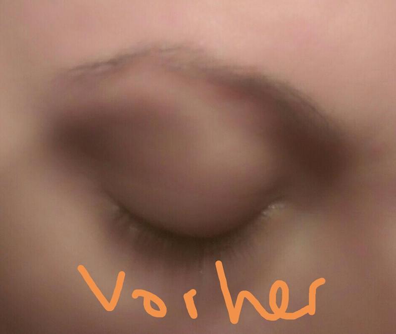 Vorher