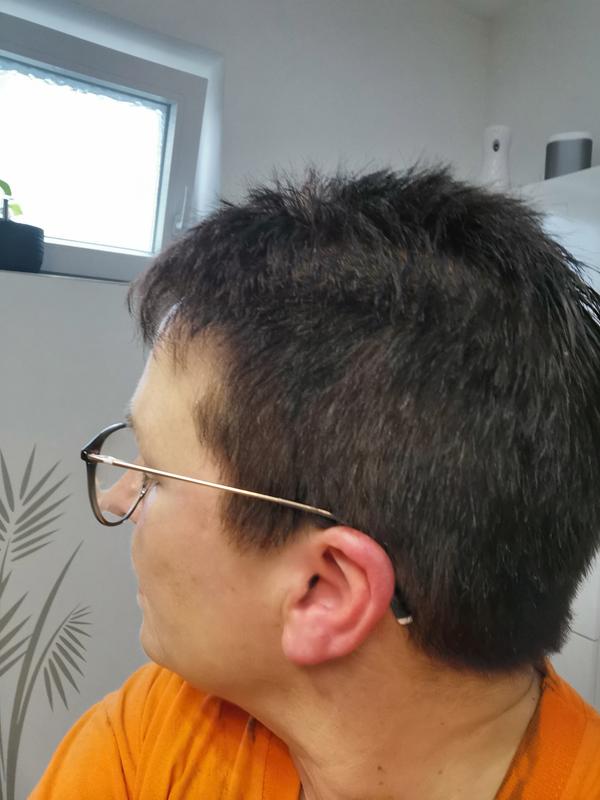 Endlich wieder chick und das nur auf dem Haar und nicht auf der Kopfhaut