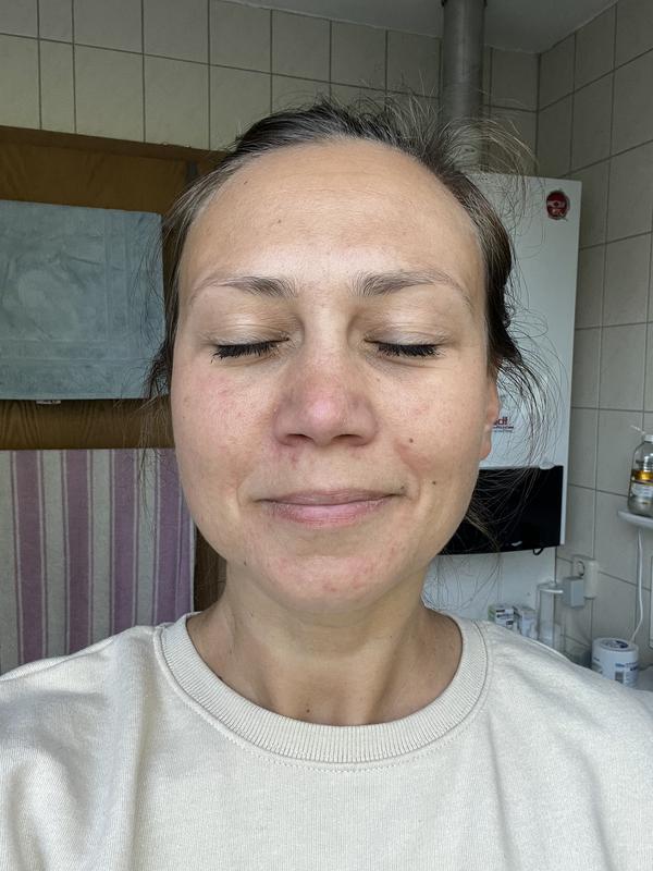 Vorher