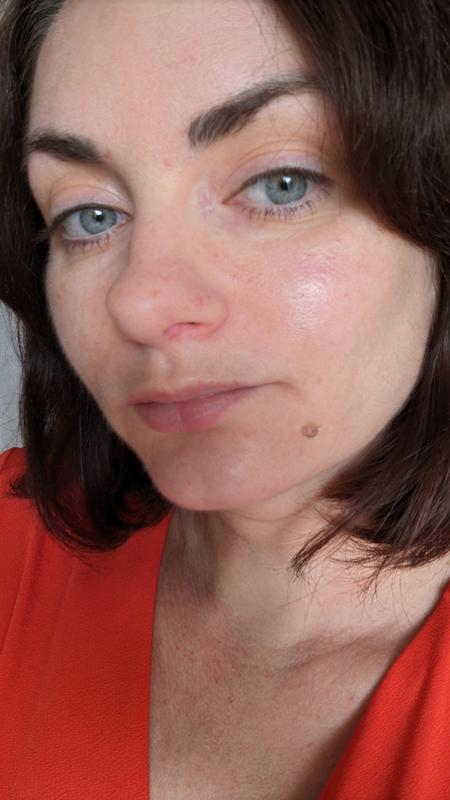 Vorher
