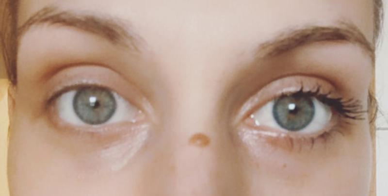 Ein Auge mit und eins ohne