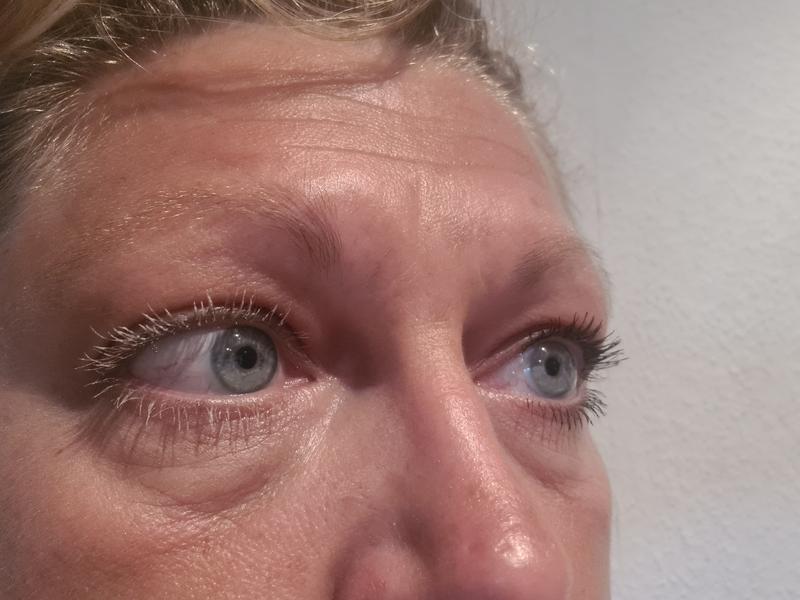Step 1 linkes Auge