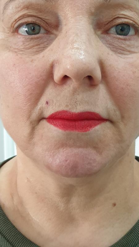 Lippen