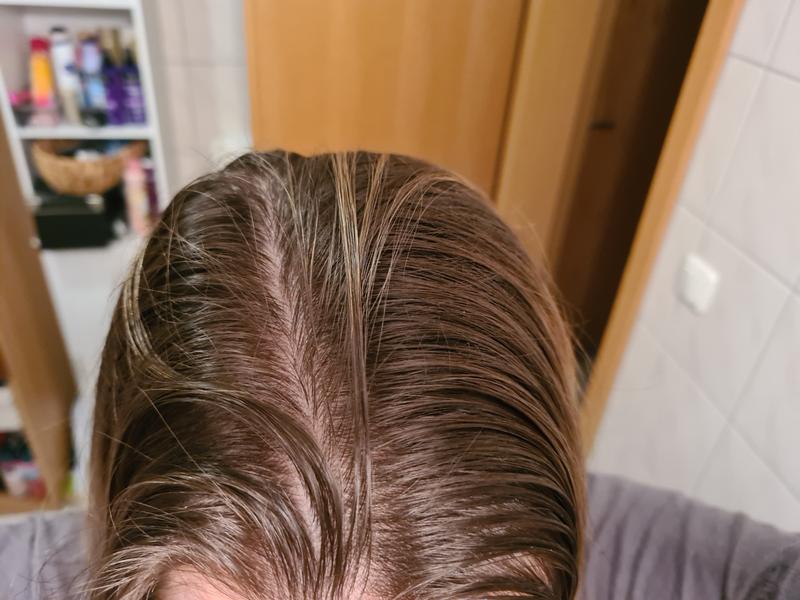Vor dem Trockenshampoo. Strähnig und fettig