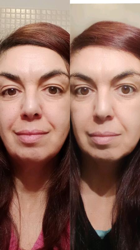 Prima e dopo 2 settimane