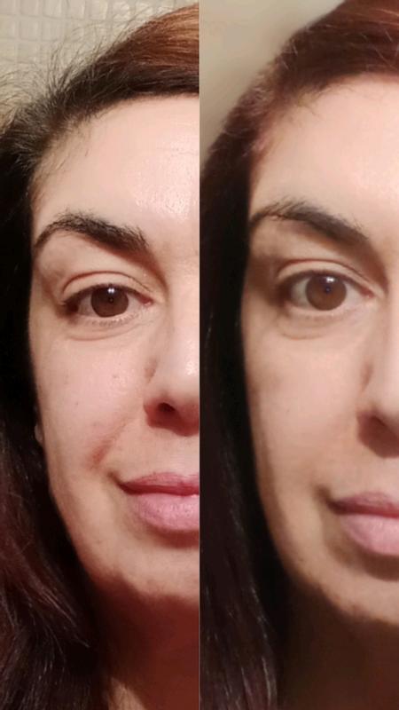 Prima e dopo 2 settimane