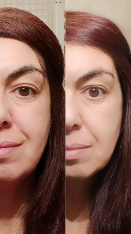 Prima e dopo 2 settimane