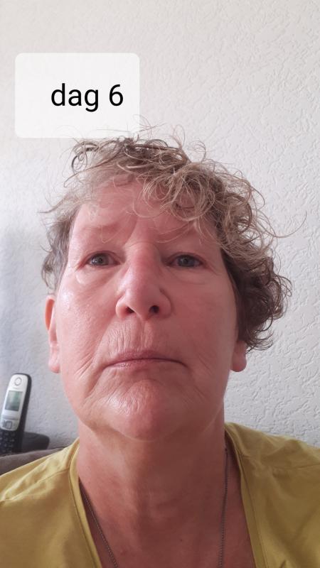 dag 6