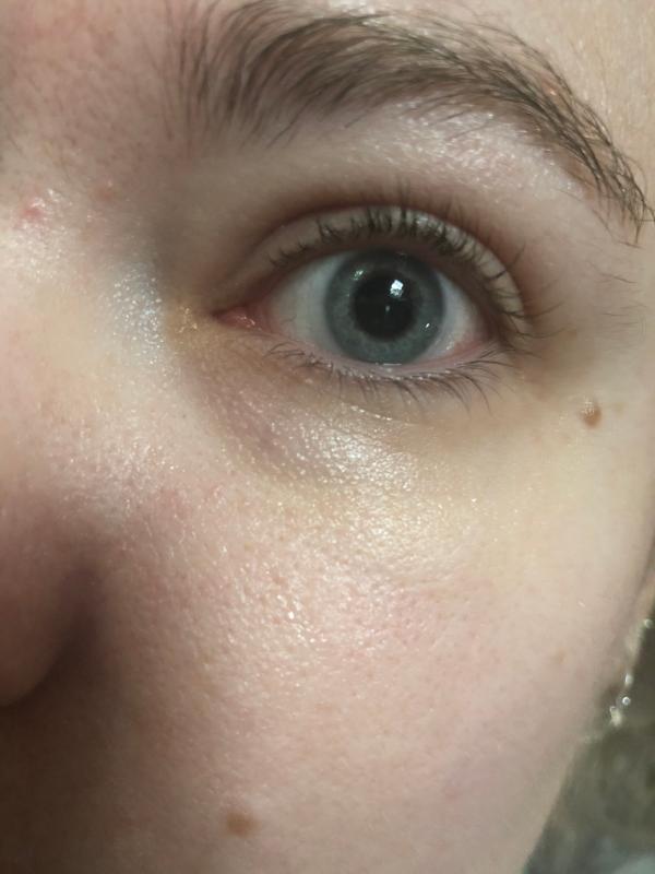 Beoordeling foto 4.