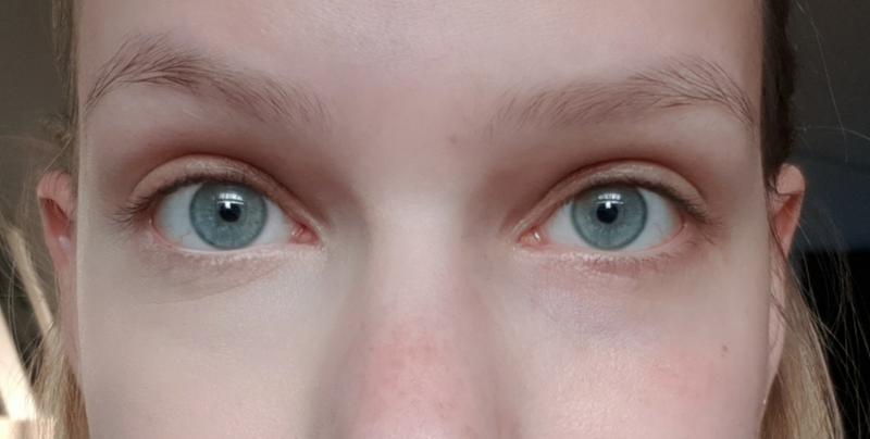 Links is met en rechts is zonder concealer