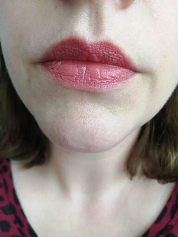 Lippen