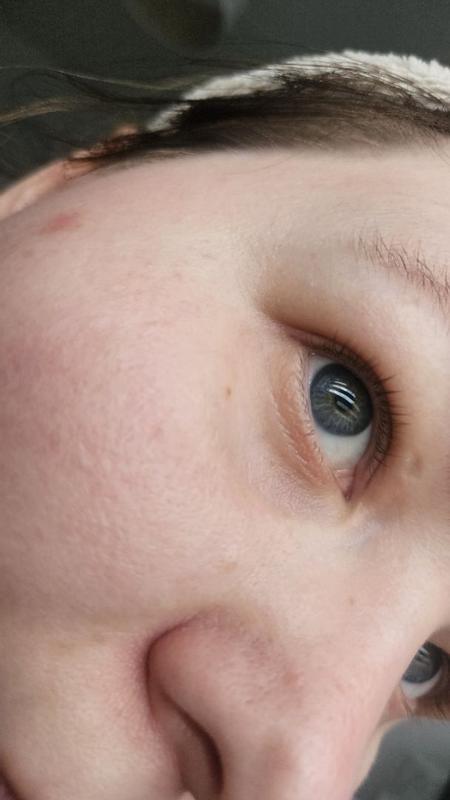 Beoordeling foto 3.
