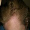 Beoordeling foto 2.