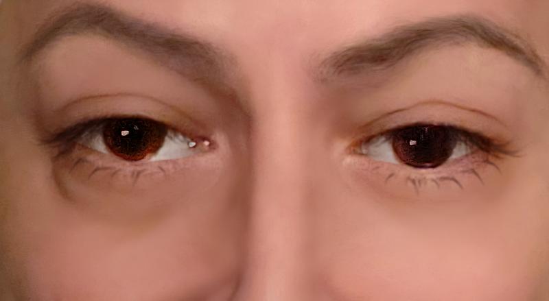 Linkeroog zonder..rechterkant MET eye bag corrector.