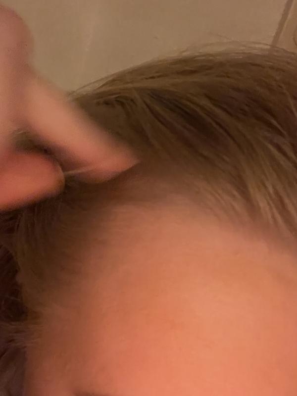 Beoordeling foto 1.