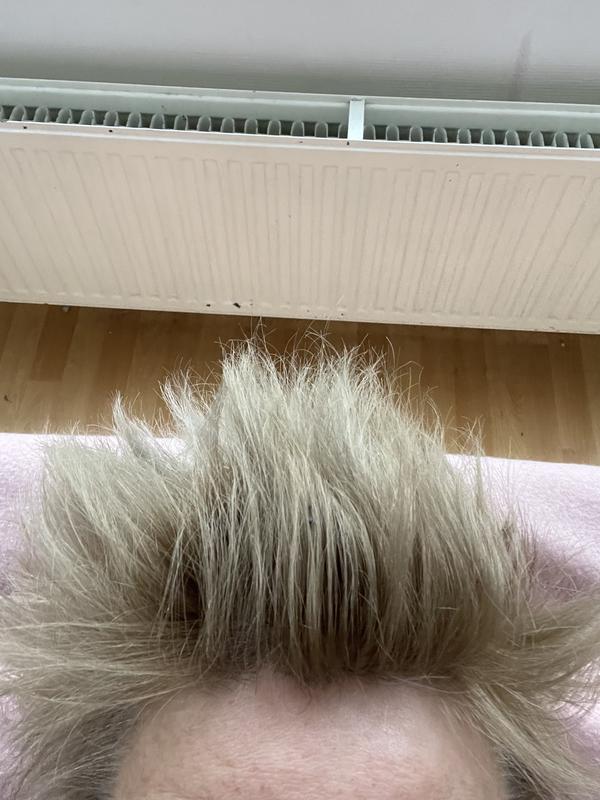 Dit is na 2 weken wassen wassen wassen, soms wel 5 x achter elkaar, om proberen op te lichten….