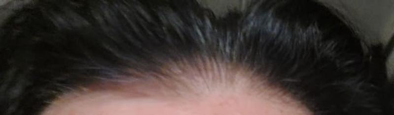 Beoordeling foto 1.