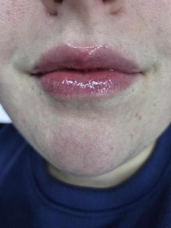 Beoordeling foto 1.