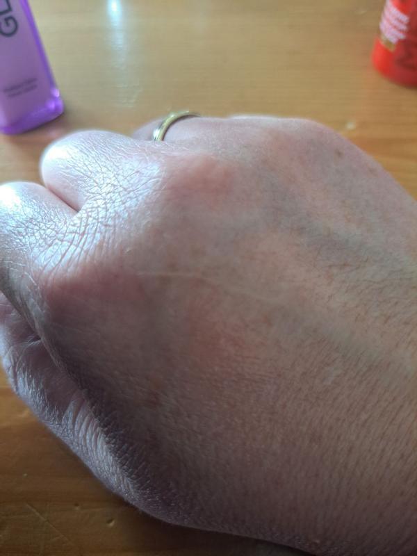 Beoordeling foto 1.