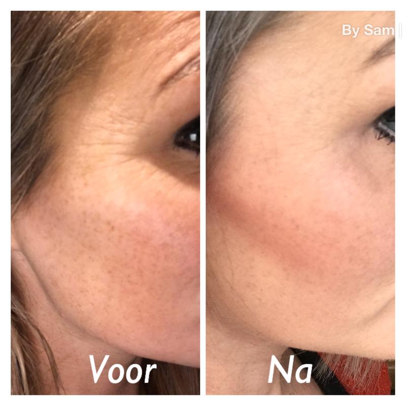 Tussen de foto’s zit twee weken.