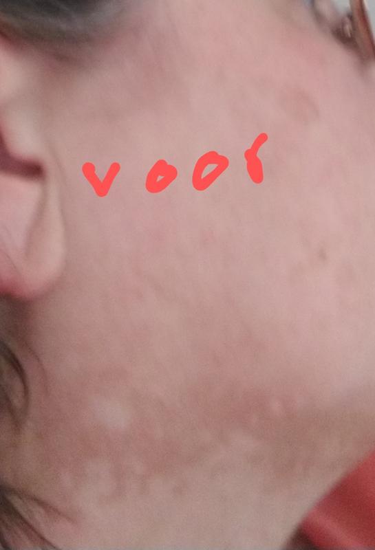 Beoordeling foto 1.