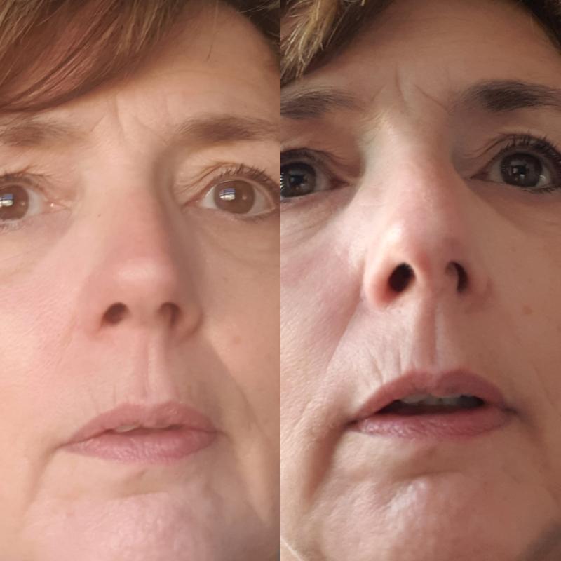 Links na een week rechts eerste dag.
