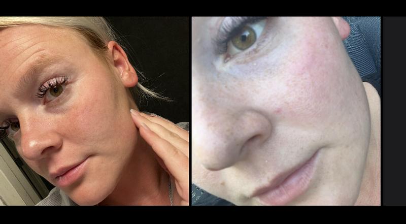 Beoordeling foto 1.