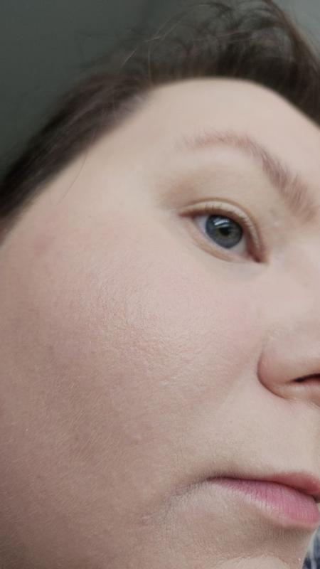 Beoordeling foto 4.