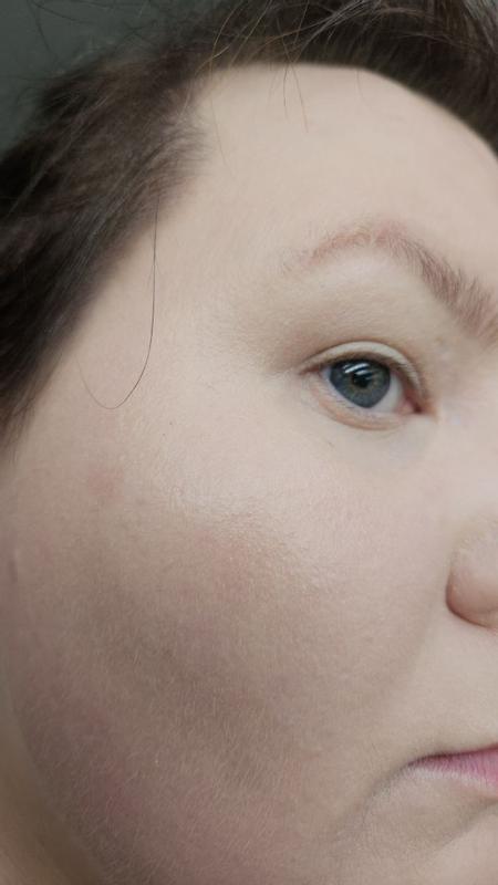 Beoordeling foto 3.