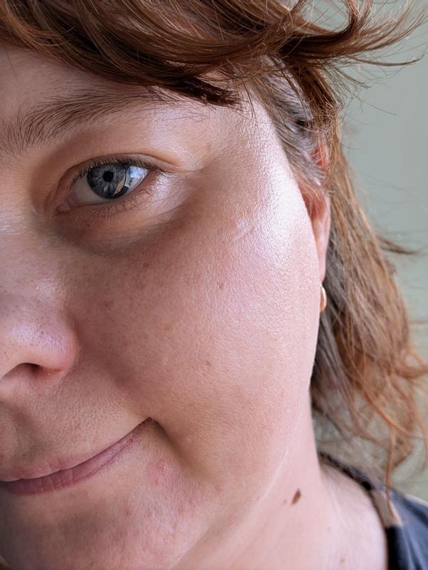 Beoordeling foto 2.